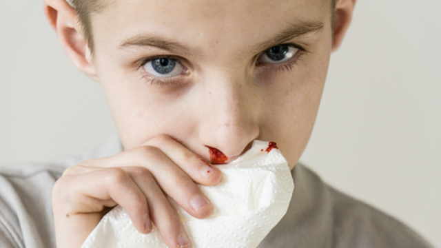 儿童经常流鼻血什么原因造成的第1张-揣书百科
