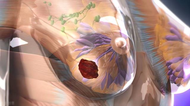 乳腺增生的治疗方法 乳腺增生吃什么药第1张-揣书百科